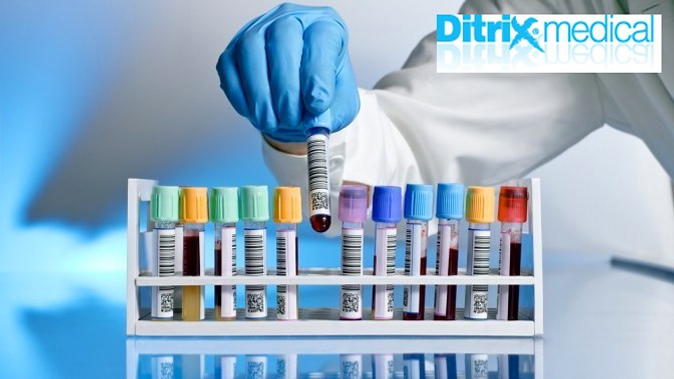 Гормональное, эндокринологическое или обследование на половые гормоны для мужчин либо женщин в лаборатории Ditrix Medical