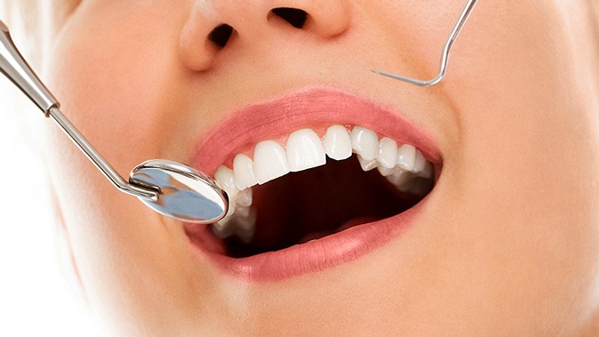 Лечение кариеса, установка пломбы, ультразвуковая чистка зубов, отбеливание по системе AirFlow, Zoom 3, эстетическая реставрация зубов в сети круглосуточных стоматологий «Специалист»