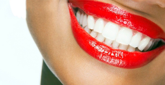 Экспресс или глубокое отбеливание зубов в студии "My Brilliant Smile"