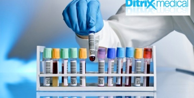 Обследование на половые гормоны в лаборатории Ditrix Medical.