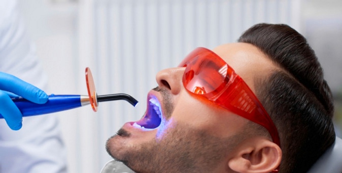 Лечение кариеса с установкой пломбы,УЗ-чистка зубов, чистка по системе AirFlow, эстетическая реставрация зубов в стоматологии Amon Dent.
