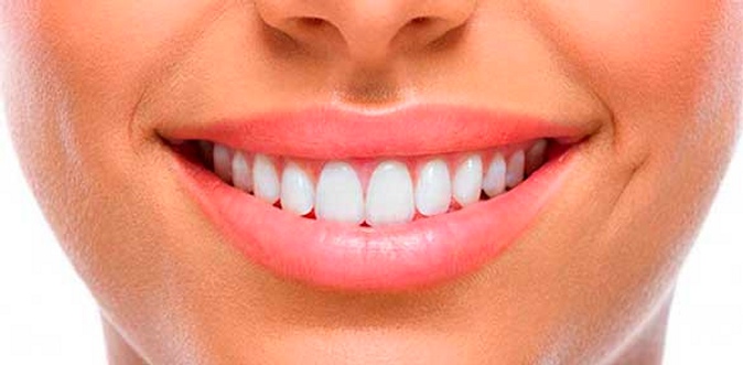 Ультразвуковая чистка зубов, лечение кариеса с установкой пломбы в клинике Smile Clinic.