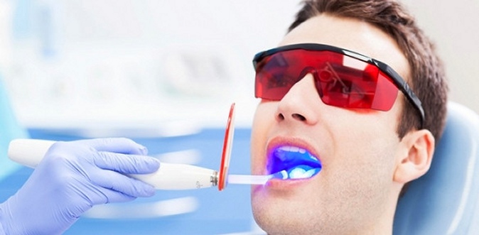 Лечение кариеса и установка пломбы на 1, 2 или 3 зуба, профессиональная гигиена полости рта либо удаление зубов в стоматологии Oganoff Clinic.