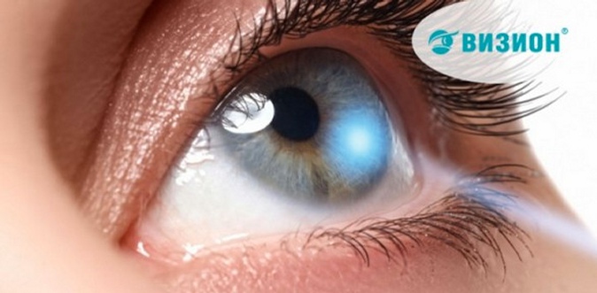 Лазерная коррекция зрения по технологии на выбор в офтальмологическом центре «Визион».
