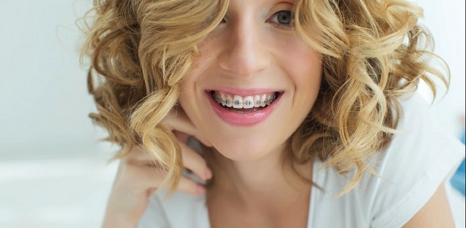 Установка металлических, керамических или сапфировых брекетов на 1 или 2 челюсти, в стоматологической клинике «Элика Дент».