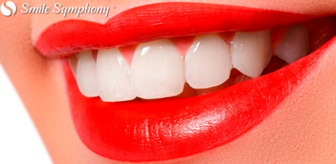 Комплексная гигиена полости рта, лечение кариеса, удаление зубов, имплантаты Cortex и Alpha Bio, установка металлокерамической коронки и многое другое в сети стоматологических клиник Smile Symphony.