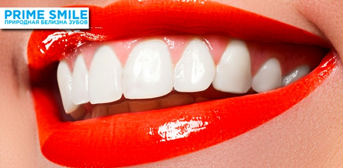 Комплексное, двойное или экспресс-отбеливание зубов до 18 тонов в студии Prime Smile.