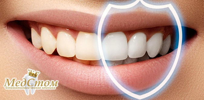 Лечение кариеса, эстетическая реставрация зубов, а также установка металлокерамической или керамической коронки в стоматологии «МедСтом».