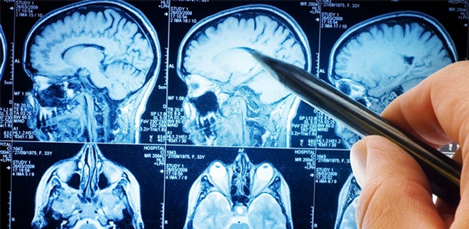 МРТ головного мозга, позвоночника, суставов на томографе открытого типа в диагностическом центре «МРТ Спектр».