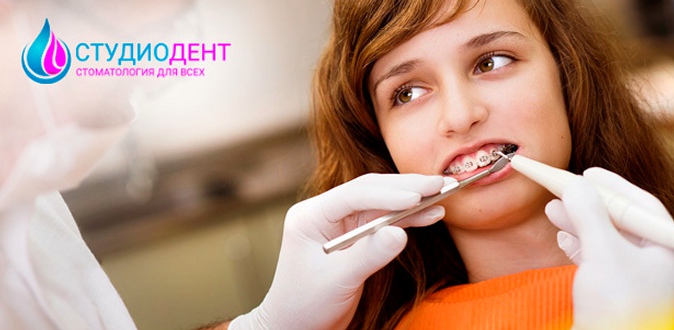 Скидка до 39% на установку брекет-системы и лечение под ключ в стоматологии «СтудиоДент»