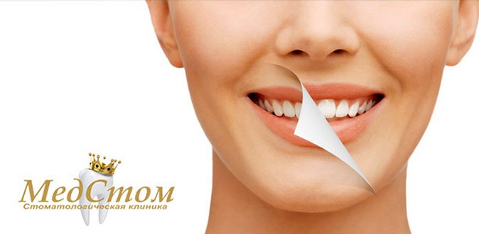 УЗ-чистка зубов с Air Flow, диагностикой полости рта, консультацией специалиста и не только в стоматологической клинике «МедСтом».