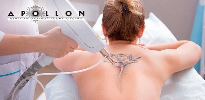 Лазерное удаление татуировки и перманентного макияжа американским лазером TriMatrixx в центре аппаратной косметологии Apollon.