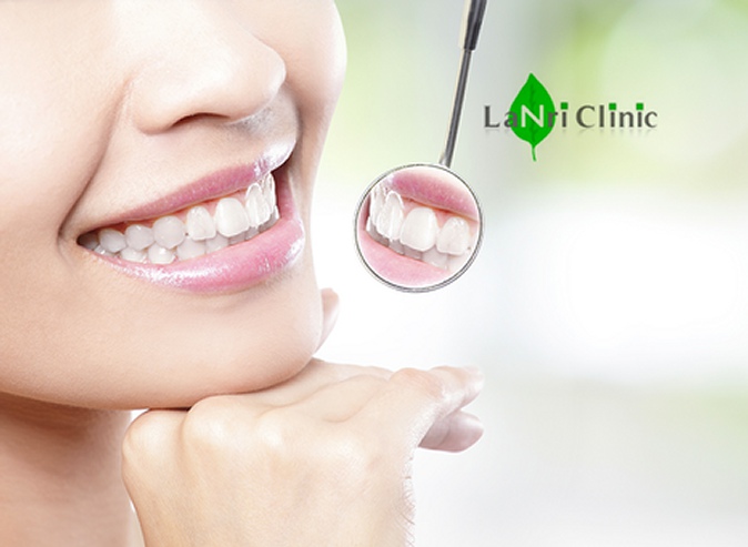 Годовое обслуживание для одного или двоих в стоматологической клинике «Lanri Clinic»