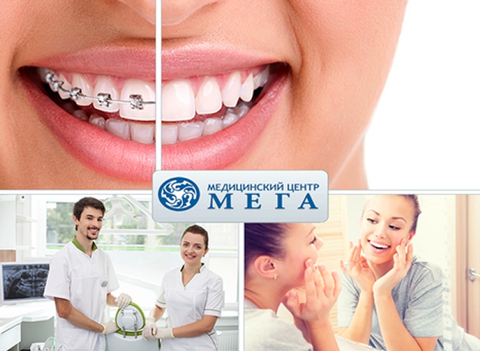 Установка металлических, керамических или сапфировых брекетов, диагностика и полировка в сети стоматологических клиник «Омега»